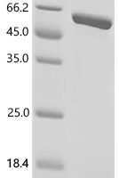 Human papillomavirus 11 Regulatory protein E2 (E2) Recombinant Protein, N-His-SUMO - BioCrest Sci