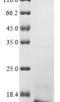 Xenopus laevis Transthyretin (ttr) Recombinant Protein - BioCrest Sci