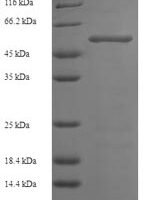 Human Hexokinase-1 (HK1), partial Recombinant Protein, N-His, aa 13–475, E.coli - BioCrest Sci