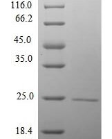 Mouse RNA polymerase II subunit A C-terminal domain phosphatase (Ctdp1), partial Recombinant Protein - BioCrest Sci