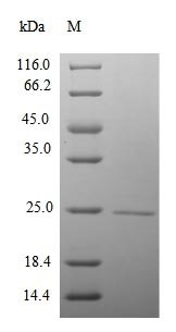 Mouse RNA polymerase II subunit A C-terminal domain phosphatase (Ctdp1), partial Recombinant Protein, Mus musculus (Mouse), E.coli, N-terminal 10xHis-tagged and C-terminal Myc-tagged, 24.0 kDa, purity >≥ 90% as determined by SDS-PAGE.