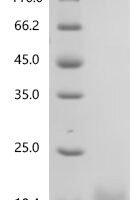 Human Growth/differentiation factor 8 (MSTN) Recombinant Protein, C-10His, Full-Length - BioCrest Sci