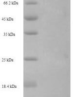 Zoarces americanus Ice-structuring protein lambda OP-3 Recombinant Protein - BioCrest Sci