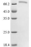Mouse CTP synthase 2 (Ctps2) Recombinant Protein - BioCrest Sci