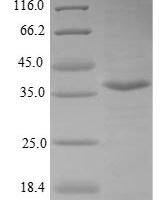 Human Valacyclovir hydrolase (BPHL) Recombinant Protein, N-10His/C-Myc, aa 38–291, E.coli - BioCrest Sci