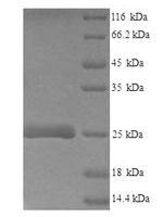 Mouse Lymphocyte antigen 6E (Ly6e) Recombinant Protein, N-His-SUMO - BioCrest Sci