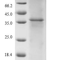 Human Titin (TTN), partial Recombinant Protein, N-10His/C-Myc - BioCrest Sci