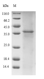 Human Titin (TTN), partial Recombinant Protein, N-10His/C-Myc, Homo sapiens (Human), E.coli, N-terminal 10xHis-tagged and C-terminal Myc-tagged, 36.9 kDa, purity >≥ 85% as determined by SDS-PAGE.