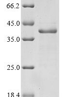 Human Integrin beta-7 (ITGB7), partial Recombinant Protein, N-GST - BioCrest Sci