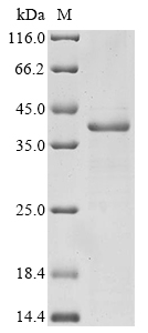 Human Integrin beta-7 (ITGB7), partial Recombinant Protein, N-GST, Homo sapiens (Human), E.coli, N-terminal GST-tagged, 42.0 kDa, purity >≥ 85% as determined by SDS-PAGE.