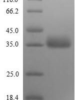 Influenza B virus Non-structural protein 1 (NS) Recombinant Protein, N-His, aa 1–281, strain B/Lee/1940, E.coli - BioCrest Sci