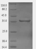 Phanerochaete chrysosporium Cellobiose dehydrogenase (CDH-1), partial Recombinant Protein - BioCrest Sci
