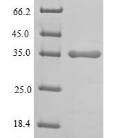 Human L-lactate dehydrogenase A chain (LDHA), partial Recombinant Protein, Tag-Free - BioCrest Sci