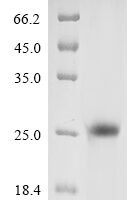 Vaccinia virus Protein L1 (L1R), partial Recombinant Protein - BioCrest Sci