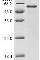 Rat Hexokinase-2 (Hk2), partial Recombinant Protein - BioCrest Sci