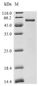 Rat Hexokinase-2 (Hk2), partial Recombinant Protein, E.coli, C-terminal 6xHis-tagged, 56.7 kDa, purity >≥ 85% as determined by SDS-PAGE.
