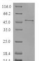 Human UPF0468 protein C16orf80 (C16orf80) Recombinant Protein - BioCrest Sci