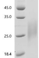 Human Interleukin-22 (IL22) Recombinant Protein - BioCrest Sci