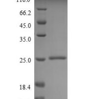 Human Mucin-2 (MUC2), partial Recombinant Protein - BioCrest Sci