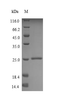 Human Mucin-2 (MUC2), partial Recombinant Protein, Homo sapiens (Human), Yeast, N-terminal 6xHis-tagged, 24.8 kDa, purity >≥ 90% as determined by SDS-PAGE.