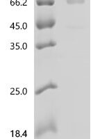 Streptococcus pneumoniae Pneumolysin (ply) Recombinant Protein, N-COL1/C-His - BioCrest Sci
