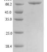 Human T-box transcription factor TBX15 (TBX15) Recombinant Protein - BioCrest Sci