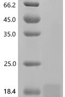 Mouse Ly-6/neurotoxin-like protein 1 (Lynx1) Recombinant Protein, C-His, aa 21–92 - BioCrest Sci