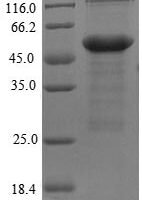Human Myosin-binding protein C, cardiac-type (MYBPC3), partial Recombinant Protein - BioCrest Sci