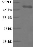 Bacillus thuringiensis subsp. Pesticidal crystal protein cry1Fb (cry1Fb), partial Recombinant Protein, N-GST - BioCrest Sci
