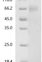 Human Interleukin-18-binding protein (IL18BP) Recombinant Protein, C-hFc1 - BioCrest Sci