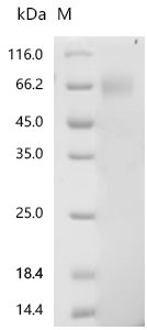 Human Interleukin-18-binding protein (IL18BP) Recombinant Protein, C-hFc1, Homo sapiens (Human), Mammalian cell, C-terminal hFc1-tagged, 45.1 kDa, purity >≥ 95% as determined by SDS-PAGE.