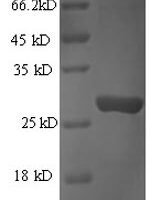 Human Granzyme B (GZMB) Recombinant Protein, N-His, aa 21–247, E.coli - BioCrest Sci