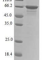 Human Non-POU domain-containing octamer-binding protein (NONO) Recombinant Protein, N-10His - BioCrest Sci
