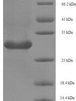 Silene chalcedonica Ribosome-inactivating protein lychnin Recombinant Protein, N-His, aa 1–234, E.coli - BioCrest Sci