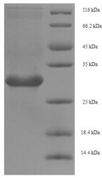 Silene chalcedonica Ribosome-inactivating protein lychnin Recombinant Protein, N-His, aa 1–234, E.coli, Silene chalcedonica (Maltese-cross) (Lychnis chalcedonica), E.coli, N-terminal 6xHis-tagged, 30.1 kDa, purity >≥ 90% as determined by SDS-PAGE.