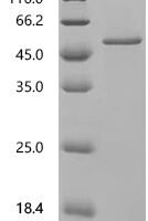 Human Serpin B10 (SERPINB10) Recombinant Protein, C-His - BioCrest Sci