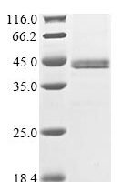 Human Sestrin-3 (SESN3) Recombinant Protein - BioCrest Sci