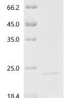 Human Interleukin-36 gamma (IL36G), Biotinylated Recombinant Protein, N-10His/C-Avi - BioCrest Sci