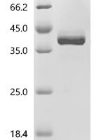 Mouse Insulin-like growth factor 1 (Igf1) Recombinant Protein, C-hFc1 - BioCrest Sci