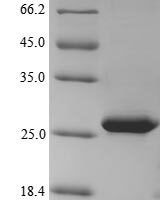 Hepatitis delta virus genotype I Large delta antigen Recombinant Protein - BioCrest Sci