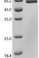 Human T-cell surface antigen CD2 (CD2), partial Recombinant Protein, C-hFc1 - BioCrest Sci