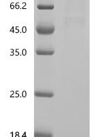 Mouse Transcription regulator protein BACH1 (Bach1) Recombinant Protein - BioCrest Sci