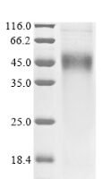 Mouse Ketohexokinase (Khk) Recombinant Protein - BioCrest Sci