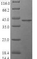 Human Caveolin-3 (CAV3) Recombinant Protein - BioCrest Sci