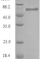 Porphyromonas gingivalis Gingipain R1 (rgpA), partial Recombinant Protein, N-His, aa 228–720, Mammalian cell - BioCrest Sci