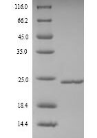 Human Metalloproteinase inhibitor 4 (TIMP4) Recombinant Protein - BioCrest Sci