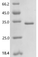 Human Peroxiredoxin-6 (PRDX6) Recombinant Protein, C-His - BioCrest Sci