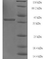 Human 26S proteasome non-ATPase regulatory subunit 10 (PSMD10) Recombinant Protein - BioCrest Sci