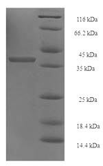 Human 26S proteasome non-ATPase regulatory subunit 10 (PSMD10) Recombinant Protein, Homo sapiens (Human), E.coli, N-terminal 6xHis-SUMO-tagged, 40.4 kDa, purity >≥ 90% as determined by SDS-PAGE.