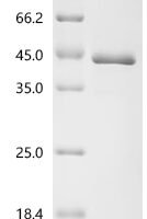 Human Filamin-C (FLNC), partial Recombinant Protein, C-His, aa 1–265, E.coli - BioCrest Sci